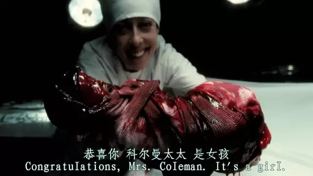 現實版孤兒怨VS電影版《孤兒怨》現實永遠比電影更恐怖，太嚇人了！