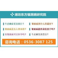 濰坊看銀屑病?？漆t(yī)院哪里專業(yè)
